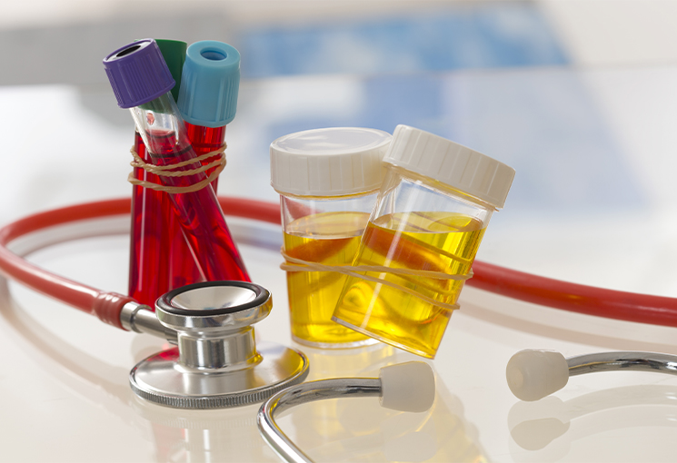 Blood and Urine Samples