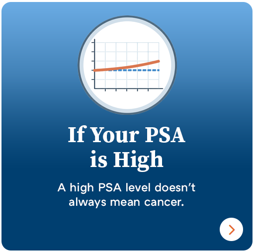 If Your PSA is High graphic